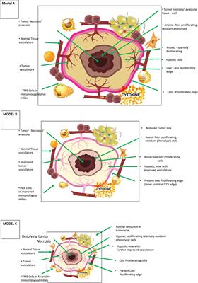 Stereotactic Body Radiotherapy Immunological Planning—A Review With a Proposed Theoretical Model